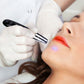 Picosecond Laser Pointer Removal Beauty Treatment